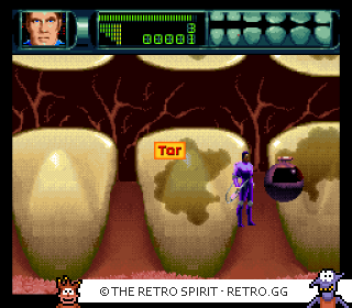 Game screenshot of Rex Ronan: Experimental Surgeon